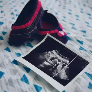 نمونه کار عکاسی بارداری توسط توکلی 